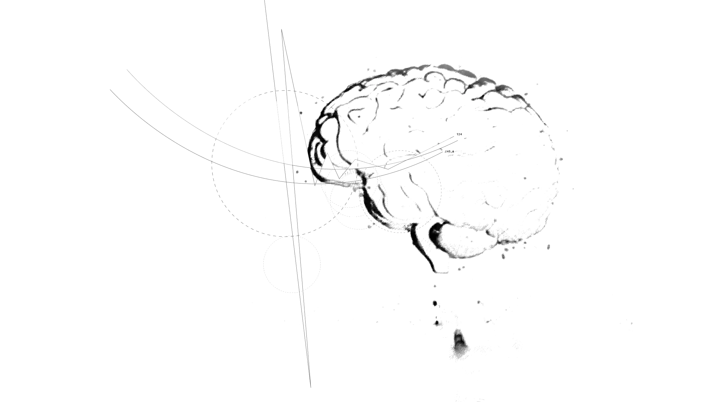BRAIN TOPOGRAPHY